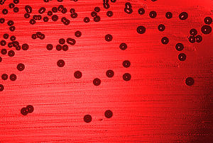 Kolonien von Haemophilus influenzae (Ordnung Pasteurellales) in einem Blutagar