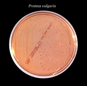 Proteus vulgaris auf einem McConkey-Agar