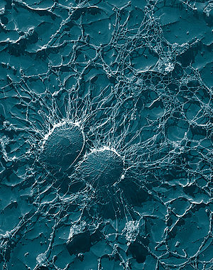 Staphylococcus aureus in 50.000facher Vergrößerung