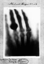 Röntgenfoto vom 22. Dezember 1895