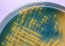 Lactose non lactose fermenters on CLED agar.jpg