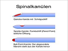 Spinal-needles.JPG