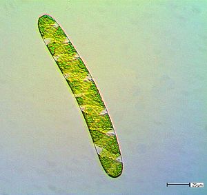 Spirotaenia condensata (28x208 µm)