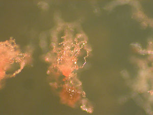 Acrasis rosea