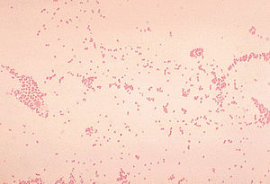 Actinobacillus lignieresi