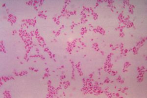 Bacteroides fragilis im Grampräparat