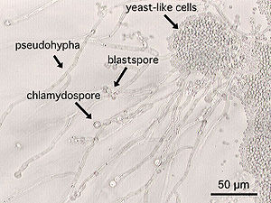 Candida albicans, Pseudohyphen (links, mit Blastokonidien und Chlamydosporen) und hefeartige Zellen (rechts)