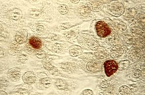 Chlamydia trachomatis, Einschlusskörperchen