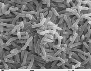 Cholera-Bakterien (Vibrio cholerae) (Sekundärelektronenmikroskopie). Typische Maße sind 2-3 Mikrometer Länge, 0,5 Mikrometer Dicke.