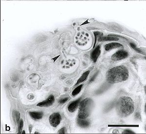 Batrachochytrium dendrobatidis (Pfeile) bei Atelopus varius