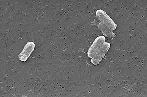 Citrobacter freundii (sekundärelektronenmikroskopisches Bild)