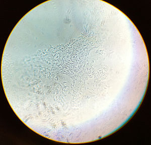 Clostridium acetobutylicum (ungefärbt, Phasenkontrastverfahren, 1000fache Vergrößerung im Ölimmersions-Lichtmikroskop)