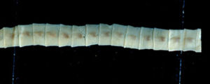 Fischbandwurm (Diphyllobothrium latum)