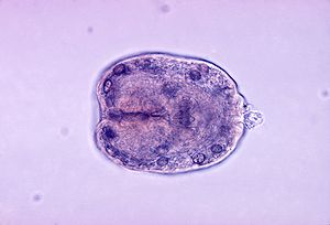 Echinococcus granulosus (Scolex)