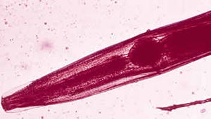 Kopf eines Madenwurms (Enterobius vermicularis), künstlich gefärbt