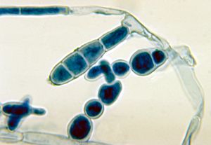 Epidermophyton floccosum
