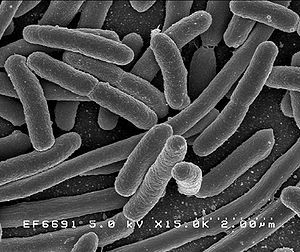 Escherichia coli sekundärelektronenmikroskopisch