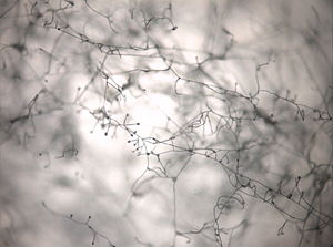 Mikroskopisches Bild des Myzels von F. verticillioides. Im Bild sichtbar sind die arttypischen Monophialiden mit kugelförmigen, zusammenklebenden Sporen an den Enden („Falsche Köpfchen“).