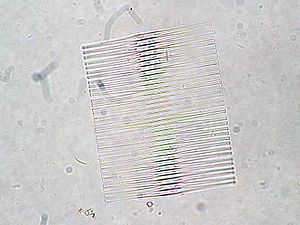 Fragilaria crotonensis