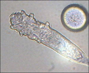 Haarbalgmilbe (Demodex folliculorum)