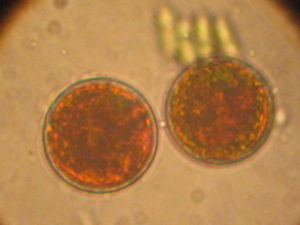 Cysten von Haematococcus pluvialis(Lichtmikroskopie)