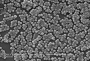 Elektronenmikroskopische Aufnahme MRSA