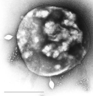 Archaeon des Genus Sulfolobus, infiziert mit dem Sulfolobus-Virus STSV1. Maßstab = 1 μm.