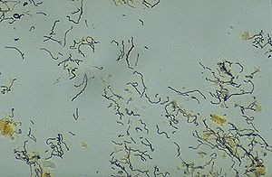 Spirochäten der Art Treponema pallidum, dem Erreger der Syphilis