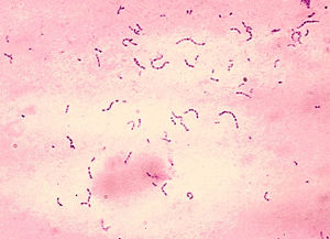 Streptococcus mutans (Gram-Färbung)