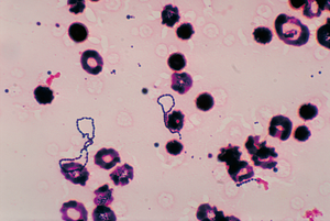 Streptococcus viridans ist eine pseudotaxonomische Bezeichnung für eine große Gruppe von im Allgemeinen nicht pathogenen Streptokokken.