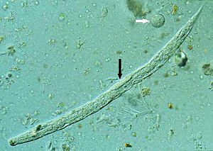1. Larve (Strongyloides stercoralis) - weißer Pfeil: Entamoeba coli