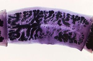 Proglottid (Taenia solium)