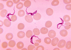 Trypanosomen im Blutausstrich eines Patienten mit afrikanischer Trypanosomiasis