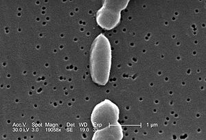 Elektronenmikroskopische Aufnahme von Vibrio parahaemolyticus