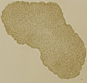 Lichtmikroskopisches Bild von Trichoplax (Individuum ca. 0,5 mm im Durchmesser)