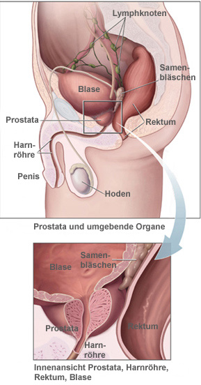 a prostatitis megjelenésének jelei a férfiakban